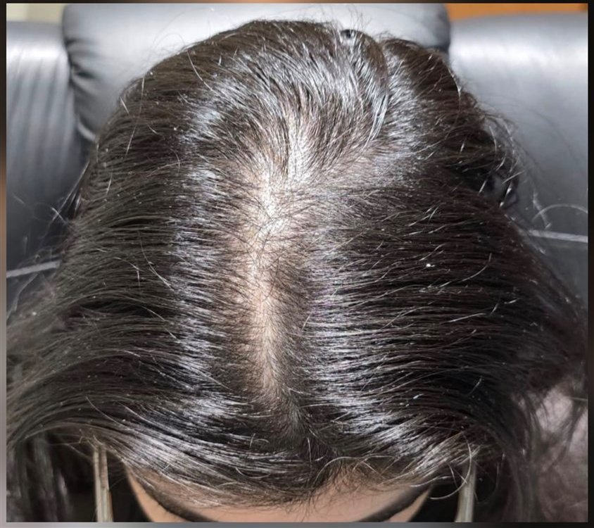 Evolución capilar femenina: después — tratamiento capilar